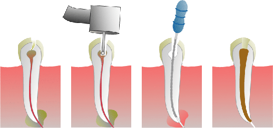 Endodontie Endodontie